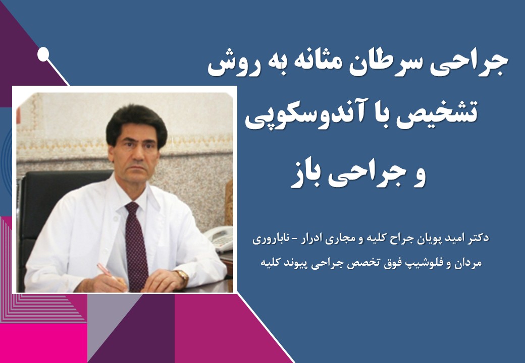 جراحی سرطان مثانه به روش تشخیص با آندوسکوپی  و جراحی باز