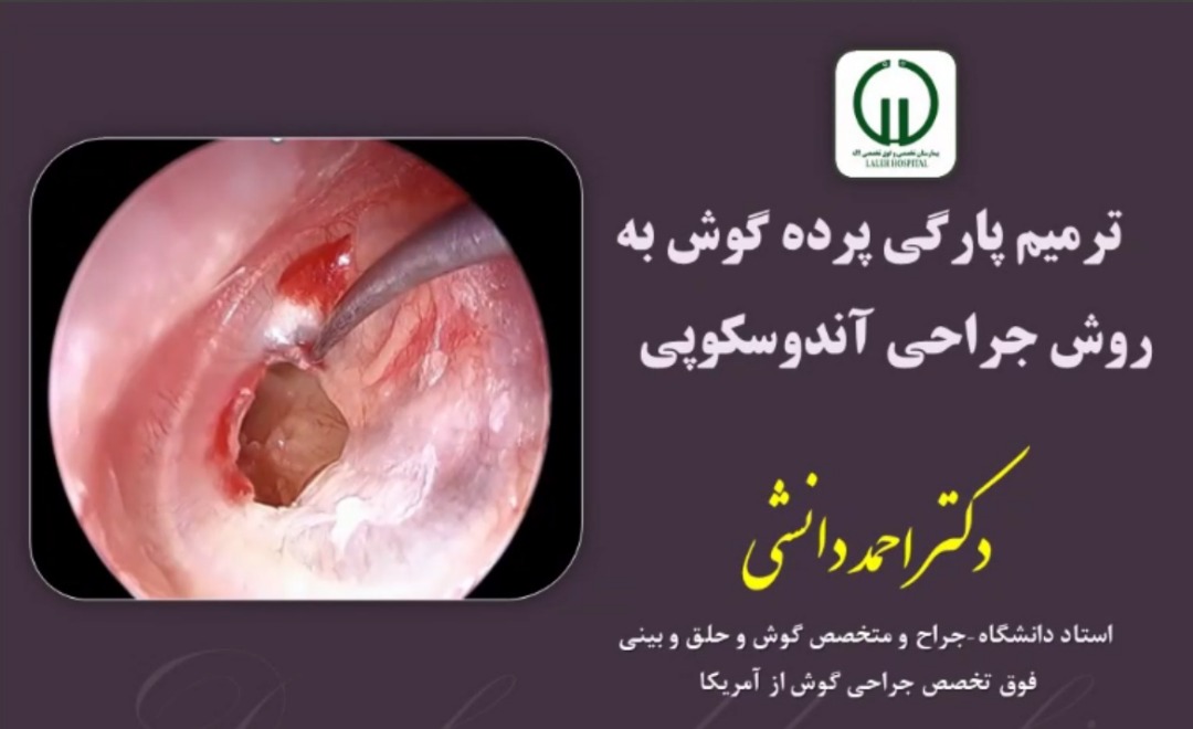ترميم پارگی پرده گوش به روش جراحی آندوسکوپی - دکتر احمد دانشی